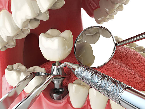 Best Emergency Treatment for Toothache in Minster, OH